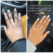 Load image into Gallery viewer, kojic acid soap before and after pictures black skin hands review
