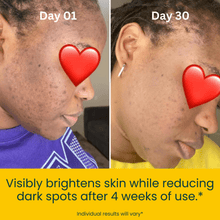 Load image into Gallery viewer, turmeric and kojic acid soap before and after photo