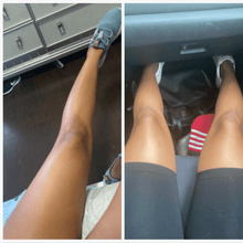 Load image into Gallery viewer, kojic acid soap before and after photos pictures knees
