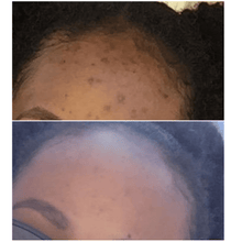 Load image into Gallery viewer, turmeric and kojic acid soap before and after photo 3
